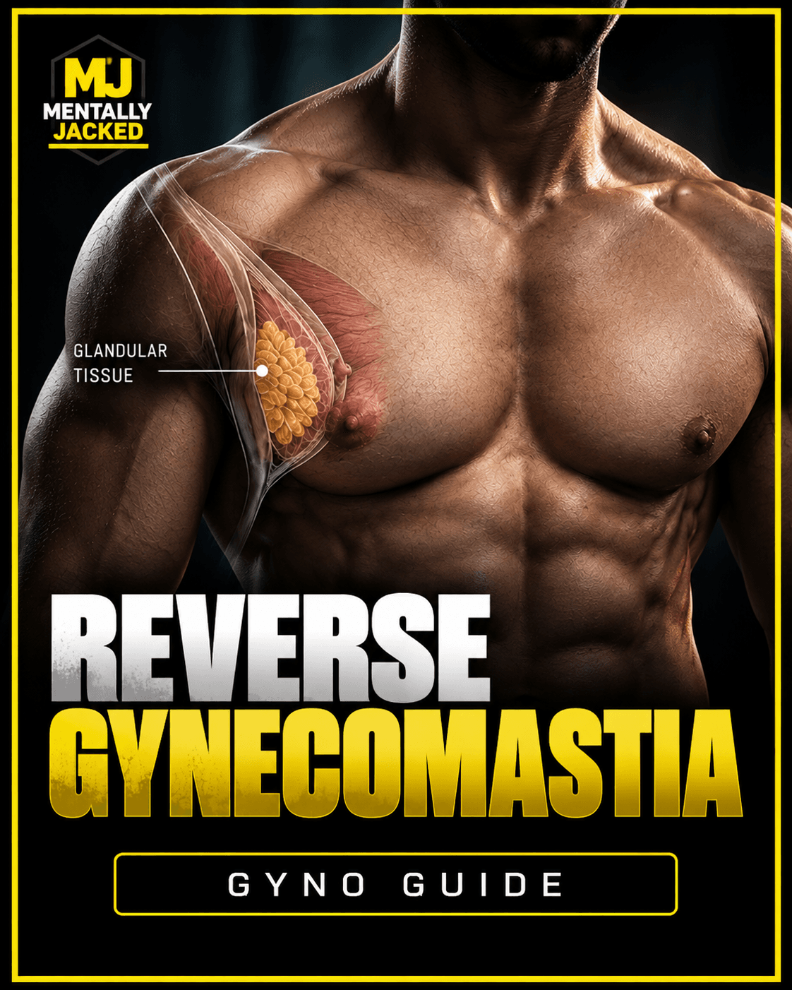 Reverse Gynecomastia — Diagnosis, Reversal & Prevention Protocol